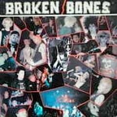 Broken Bones : Never Say Die